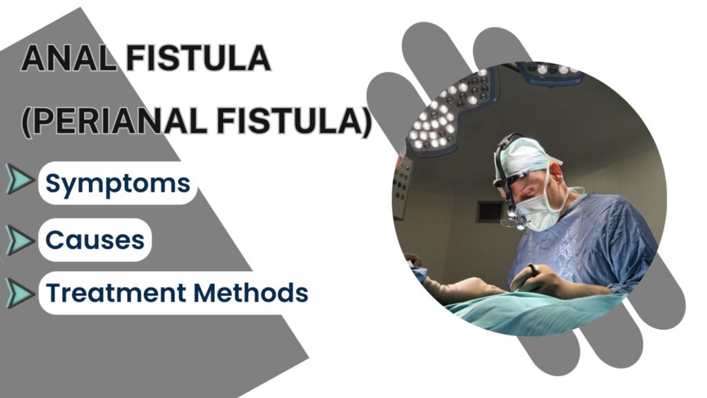 Perianal Fistula: What Is It? Symptoms of Anal Fistula