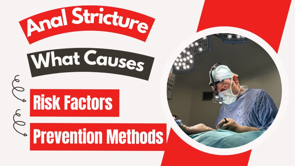 What Causes Anal Stricture? Risk Factors and Prevention Methods