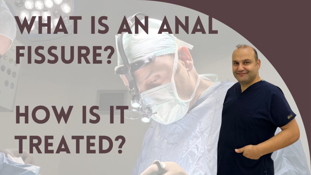 What Is an Anal Fissure? How Is It Treated?