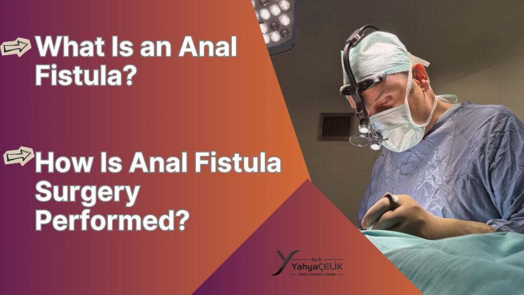 What Is an Anal Fistula? How Is Anal Fistula Surgery Performed?