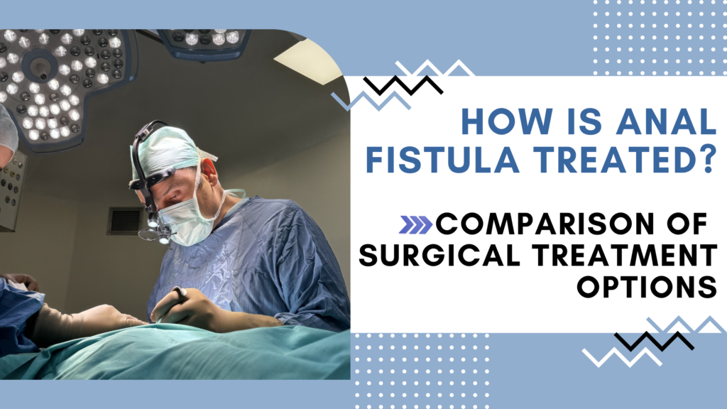 How Is Anal Fistula Treated? Comparison of Surgical Treatment Options