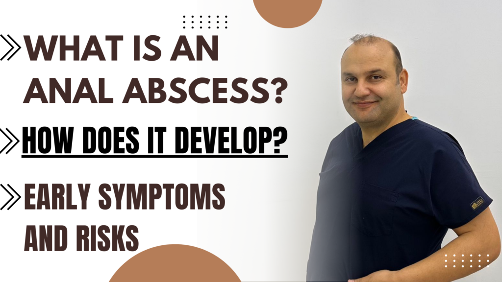 What Is an Anal Abscess? How Does It Develop? Early Symptoms and Risks