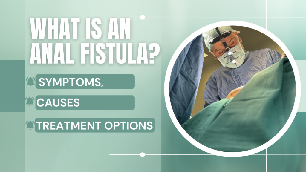 What Is an Anal Fistula? Symptoms, Causes, and Treatment Options