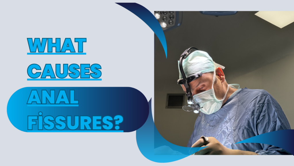 What Causes Anal Fissures?