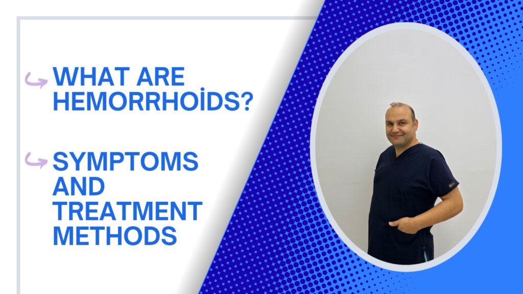 Hemorrhoids: Symptoms and Treatment Methods