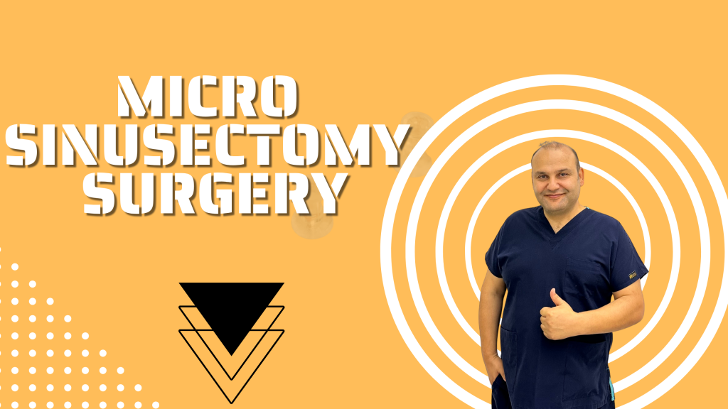 Micro Sinusectomy Surgery
