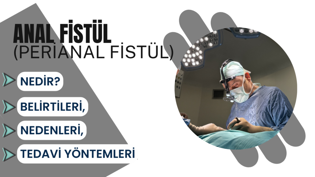 Anal Fistül (Perianal Fistül) Nedir? Belirtileri, Nedenleri ve Tedavi Yöntemleri