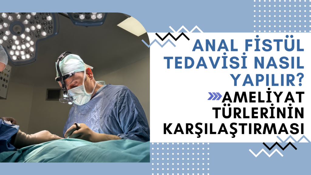 Anal Fistül Tedavisi Nasıl Yapılır? Ameliyat Türlerinin Karşılaştırması