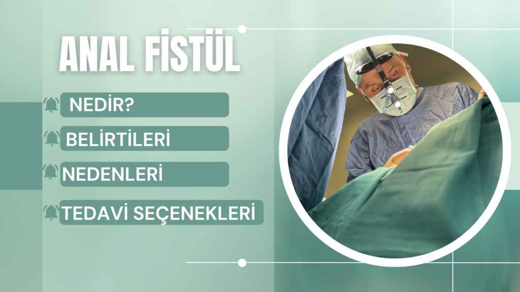 Anal Fistül Nedir? Belirtileri, Nedenleri ve Tedavi Seçenekleri