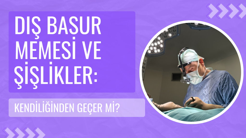 Dış Basur Memesi ve Şişlikler Kendiliğinden Geçer mi?