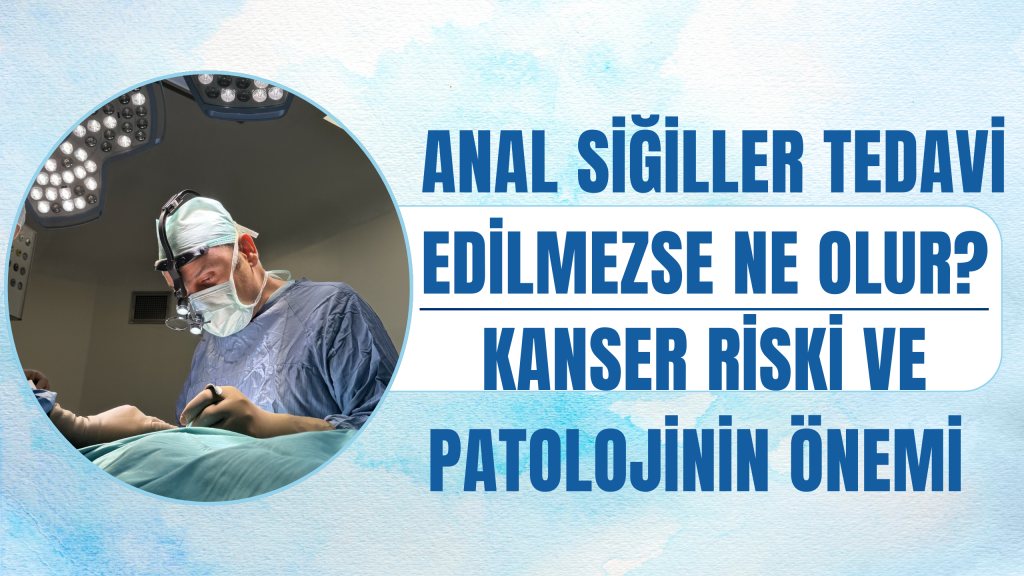 Anal Siğiller Tedavi Edilmezse Ne Olur?